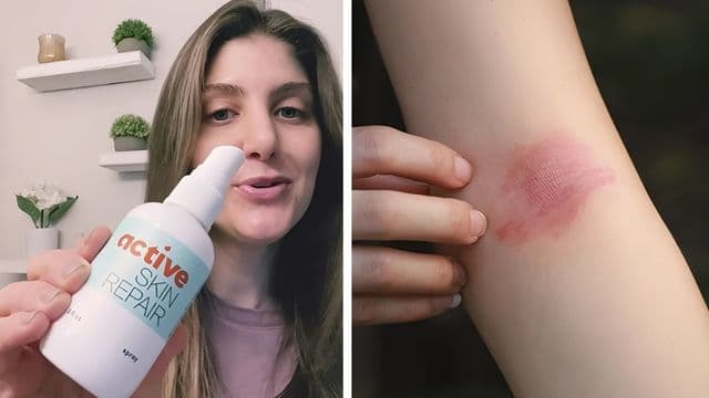 Active Skin Repair